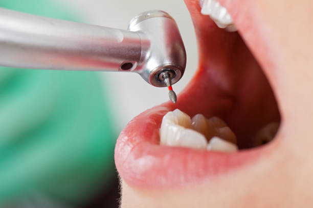 Best Emergency Dental Care for Sports Injuries in Haskell, OK